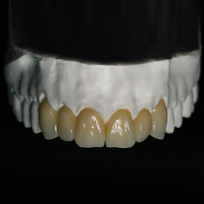 Zirconia Layered