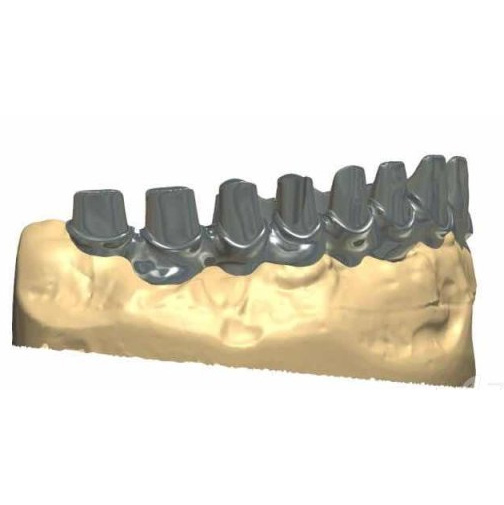 Milling Titanium Abutment