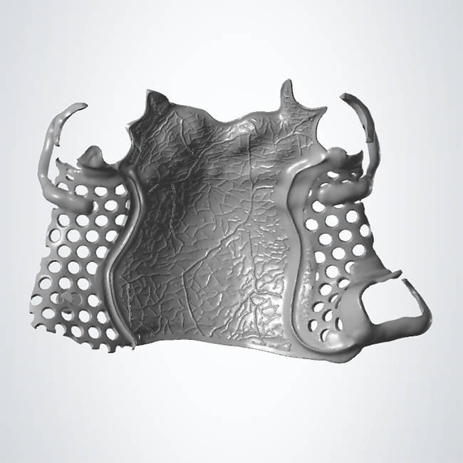 Milling Titanium Framework